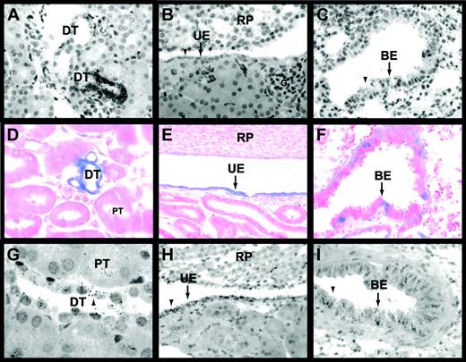 Fig. 5. Egr-1 and TF expression in the kidneys and lungs of untreated and LPS-treated mice. / In situ hybridization experiments using an antisense Egr-1 riboprobe (A-C) detected Egr-1 mRNA expression in epithelial cells of distal tubules (A), urinary epithelium (B), and the bronchial epithelium (C) of untreated mice. Black grains indicate Egr-1–positive cells. LacZ expression (D-F) was analyzed in tissues from LPS-treated (2 hours) Egr-1+/−(LacZ) mice. Distal tubules (D), urinary epithelium (E), and bronchial epithelium (F) expressed LacZ (blue). In situ hybridization experiments (G-I) showed that TF mRNA was expressed by distal tubules (G), urinary epithelium (H), and bronchial epithelium (I) in LPS-treated (8 hours) mice. Original magnification was × 400 for all panels except panels D and G (× 1000). BE indicates bronchial epithelium; DT, distal tubule; G, glomerulus; PT, proximal tubule; RP, renal papilla; and UE, urinary epithelium. Arrowheads indicate Egr-1– and TF mRNA–positive cells.