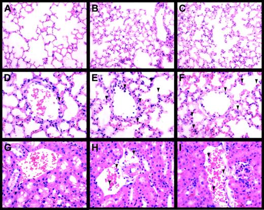 Fig. 6. LPS-induced inflammation in the lung and kidney. / Lungs (A-F) and kidneys (G-I) from control (A,D,G), LPS-treated (8 hours) Egr-1+/+ (B,E,H), and LPS-treated (8 hours) Egr-1−/− (C,F,I) mice were stained with hematoxylin and eosin. Original magnification was × 250 (A-C) and × 400 (D-I). Leukocytes are indicated by the arrowheads.
