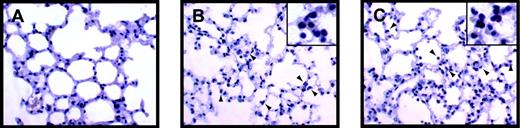 Fig. 7. LPS-induced inflammation in the lung. / Leukocytes present in lungs from control (A), LPS-treated (8 hours) Egr-1+/+ (B), and LPS-treated (8 hours) Egr-1−/− (C) mice were stained with the napthol AS-D chloroacetate esterase reaction. Red-stained leukocytes are indicated by the arrowheads.