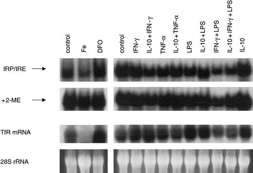 Fig. 1. Effect of iron perturbations, pro- and anti-inflammatory cytokines on IRP binding affinity and TfR mRNA levels in activated macrophages. / THP-1 cells were treated with either ferric iron chloride (50 μM), desferrioxamine (DFO, 100 μM), IFN-γ (100 U/mL), LPS (10 μg/mL), a combination of IFN-γ+LPS, TNF-α (100 U/mL), or IL-10 (10 ng/mL), the latter being added to cells 2 hours prior to stimulation with the other cytokines. IRP activity was determined by electrophoreticmobility shift assays as described in “Materials and methods.” Two percent of 2-mercaptoethanol (2-ME) was used to fully activate IRP binding affinity. The resulting IRE/IRP complex is indicated by an arrow. TfR mRNA expression was carried out by Northern blot. Staining for 28 S rRNA was used to ensure that all lanes have been equally loaded. Shown is 1 of 3 experiments.