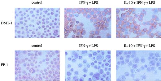 Fig. 6. Effect of cytokines on cellular expression of DMT-1 and ferroportin. / Cells were left untreated (control) or stimulated with IFN-γ (100 U/mL) and LPS (10 μg/mL) for 20 hours following preincubation with IL-10 (10 ng/mL) for 2 hours or not. Cells were fixed to cytospin slides and incubated with either anti–DMT-1 or anti–ferroportin-1(FP-1) antiserum as described in “Materials and methods.” Shown is 1 of 3 experiments. Original magnification, × 400.