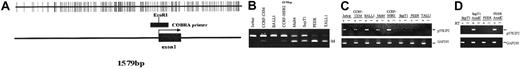 Fig. 1. P57KIP2 methylation in ALL cell lines. / (A) Map of the promoter-associated CpG island of p57KIP2 in relation to exon 1 and its transcription start site (arrow). Each vertical line represents a CpG site. (B) Combined bisulfite restriction PCR analysis of p57KIP2 in ALL cell lines. The restricted band (M) represents the methylated allele. (C) RT-PCR analysis of p57KIP2 gene expression in methylated and unmethylated cell lines. + indicates with reverse transcriptase (RT); −, without. Bottom blots show GAPDH control. (D) RT-PCR analysis of p57KIP2 before and after 5-aza-2′-deoxycytidine (AzadC) exposure.