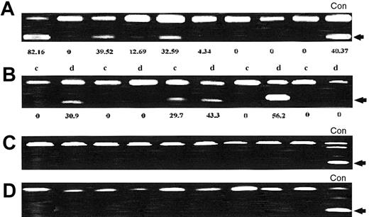 Fig. 3. p57KIP2 methylation analysis in patients with ALL. / (A) p57KIP2 methylation analysis at initial presentation. Restricted band (arrow) indicates methylated allele. The number underneath each lane represents the level of methylation. (B) Analysis of p57KIP2 methylation in paired matched samples obtained at initial presentation (c) and at relapse (d). The number underneath each lane represents the level of methylation. (C) Methylation of p21CIP1 in ALL patients. (D) Methylation analysis of p14ARF in ALL patients. None of the patients analyzed had methylation of p21CIP1 or p14ARF. (Con = control cell lines).