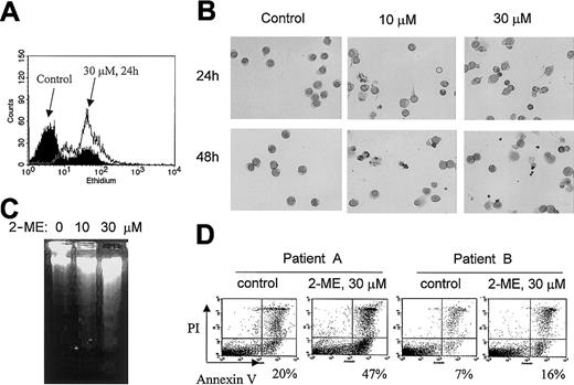 Fig. 1. Induction of O2− accumulation and apoptosis by 2-ME in CLL cells. / (A) Accumulation of O2− in primary CLL cells treated with 30 μM 2-ME for 24 hours. Primary leukemia cells freshly isolated from patients with CLL were treated with 2-ME in vitro and the O2− levels were determined by flow cytometry analysis as described in “Materials and methods.” (B) Morphologic changes characteristic of apoptosis induced by 2-ME in CLL cells. After cells were incubated with 2-ME under the conditions indicated, the samples were stained and photographed as described in “Materials and methods.” All photographs show microscopic view using × 60 objective. (C) 2-ME induced DNA fragmentation in CLL cells treated with 10 or 30 μM 2-ME for 72 hours. (D) 2-ME induced apoptosis in CLL cells as measured by annexin V reactivity using a flow cytometry analysis. The number shown below each panel indicates the percentage of annexin-positive cells.