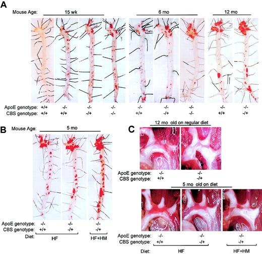 Fig. 1. Sudan IV staining and gross appearance of atherosclerotic lesions in mouse aortas. / Mice were killed at the ages indicated. Lesions were examined by Sudan IV staining (A,B) and by direct photography (C). Lesions showed up as red (A,B) and white (C) plaques. The extent of atherosclerotic lesions is shown in Figure 2. Original magnification, × 6.5.