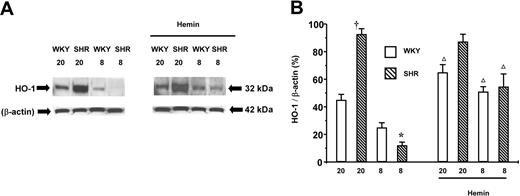 Fig. 2. HO-1 expression in the aortas of adult (20-week-old) and young (8-week-old) SHRs and WKYs. / Representative Western immunoblotting (A) and the mean relative abundant levels of expressed proteins (B) revealed a significantly increased expression of HO-1 protein in the aortas from young SHRs that received hemin treatment. The basal HO-1 expression level from adult SHRs was significantly greater than in the age-matched WKYs, which were not affected by hemin. †P < .01 versus age-matched WKYs. *P < .05 versus all other groups. ΔP < .05 versus age-matched animals of same species without hemin treatment. The ages of the animals in weeks are indicated as “20” and “8” in (A) and (B). n = 4 for each group. Error bars indicate means ± SEM.
