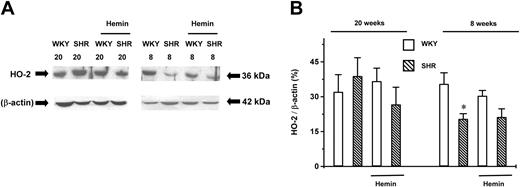 Fig. 3. Expression of HO-2 in the aortas of adult (20-week-old) and young (8-week-old) SHRs and age-matched WKYs. / Representative Western immunoblotting (A) and the mean relative abundant levels of expressed proteins (B) revealed a significantly lower HO-2 expression level in 8-week-old SHRs, which were unaffected by hemin treatment. *P < .05 versus age-matched WKYs. The ages of the animals in weeks are indicated by the numbers “20” and “8” in (A). n = 4 for each group. Error bars indicate means ± SEM.