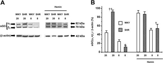 Fig. 5. Expression of sGC proteins in the aortas of adult (20-week-old) and young (8-week-old) SHRs and WKYs. / Representative Western immunoblotting (A) and the mean relative abundant levels of expressed proteins (B) indicated a depressed basal sGC expression in 8-week-old SHRs. Hemin treatment significantly increased sGC expression in 8-week-old SHRs and in WKYs of all ages, although a higher magnitude of increase was registered in 8-week-old SHRs (†P < .05). ††P < .01 versus age-matched WKYs. *P < .05 versus all other groups. The ages of the animals in weeks were indicated as “20” and “8” in (A) and (B). n = 4 for each group. Error bars indicate means ± SEM.