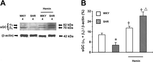 Fig. 6. Expression of sGC proteins in the aortas of 4-week-old SHRs and WKYs. / Representative Western immunoblotting (A) and the mean relative abundant levels of expressed proteins (B) indicated a lower basal level of sGC expression in SHRs, which were enhanced by hemin treatment. *P < .05 versus age-matched WKYs. †P < .05 versus age-matched animals of the same species but without hemin treatment. ΔP < .05 versus age-matched and hemin-treated WKYs. n = 4 for each group. Unlabeled bars indicate untreated animals. Error bars indicate means ± SEM.