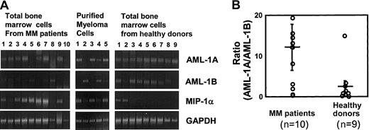 Fig. 8. mRNA expression levels of AML-1A and AML-1B in patients with MM versus healthy controls. / mRNA expression levels of MIP-1α, AML-1A, and AML-1B were examined by RT-PCR analysis in total bone marrow cells and purified CD138+ myeloma cells from patients with MM, compared with samples from healthy donors. mRNA expression levels of MIP-1α were increased in 7 of 10 total bone marrow cells and 3 of 5 CD138+ myeloma cells from patients with MM. mRNA expression levels of AML-1B were decreased in 5 of 7 total bone marrow cells and 2 of 3 myeloma cells from patients with MM who showed increased MIP-1α expression. AML-1A mRNA expression was detected in 8 of 10 and 4 of 5 myeloma cells from patients with MM, and 9 of 9 normal samples (A). The ratio of mRNA expression of AML-1A to AML-1B was 8-fold higher in patients with MM than in healthy controls and was increased more than 10-fold in patients with increased MIP-1α expression, such as in patients 1, 3, 4, 5, 6, 7, and 9 (P = .022) (B). Horizontal bars indicate the average; vertical bars, SE.
