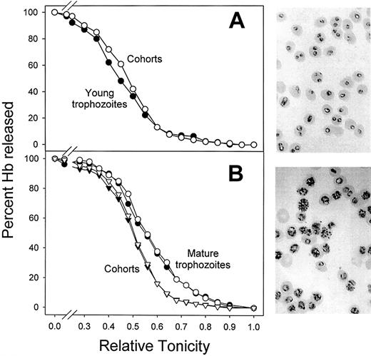 Fig. 4. Osmotic fragility curves of IRBCs obtained from synchronized. / P falciparum cultures. The IRBCs contained either young (A) or mature (B) parasite forms. The osmotic fragility measurements were performed as described for Figure3, using mostly uninfected cohort cells as controls. Synchronization was performed as described in “Materials and methods.” Micrographs of representative fields from Giemsa-stained smears of the synchronized, concentrated cultures used for the osmotic fragility measurements are shown on the right of the corresponding figures (original magnification, × 1000). (A) A single experiment with culture containing rings and young trophozoite stage parasites. Top fraction (●): 91% parasitemia, all rings and young trophozoites. Bottom fraction (○; cohorts): 94% uninfected cells, 6% rings. (B) Shown is 1 of 2 identical experiments with similar results. The culture contained mature stage trophozoites and 1.2% ring-stage parasites before final gelatin flotation. Top fraction (●, ○): 86% parasitemia, 33% mature trophozoites, and 53% schizonts and segmentors. Bottom fraction (▾, ▿): 97% uninfected cohorts and 3% rings.