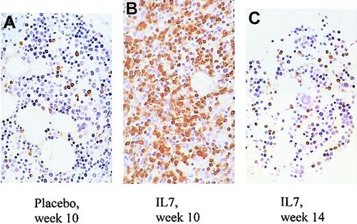 Fig. 4. Changes in bone marrow of treated and placebo animals. / Increased overall cellularity, increased percentage of T cells, and decreased number of megakaryocytes in the marrow of an IL-7–treated animal (B) compared with a placebo-treated animal (A) at the end of treatment (week 10). By week 14, the abnormalities observed in the same IL-7–treated animal at week 10 have abated (C). CD3 immunostain is shown in brown. CD4 and CD8 immunostains could not be performed due to a technical problem. Original magnification, × 80.