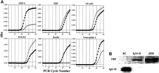 Fig. 3. Representative confirmation analysis by real-time quantitative RT-PCR and Western blot. / (A) Representative plots confirming alterations in expression of select genes in plasma cells (▪) versus IgM+ B cells (⋄) by real-time quantitative RT-PCR are shown. ΔRn represents the reporter signal with the baseline subtracted. The threshold cycle (CT) values for these genes as well as additional genes are listed in Table 1. The threshold is indicated by the dotted line. (B) The expression of TBP protein in plasma cells and IgM+ B cells was determined by Western blot. The J558 murine plasmacytoma cell line was used as a positive control for TBP. To control for sufficient protein in plasma cell samples, lysates were examined for the presence of IgG using a polyclonal goat antimouse IgG antibody.