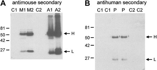 Fig. 1. Autoimmune antibodies bound to the RBC membranes. / RBC membranes were prepared as described in “Materials and methods.” Aggregates that formed during the band 3(−/−) mouse membrane preparations were homogenized (see “Materials and methods”). Proteins were separated on 10% SDS-PAGE gels and were immunoblotted with HRP-conjugated, antimouse (A), or antihuman (B) secondary antibody. H and L indicate the positions of the immunoglobulin H and L chains. Mouse RBC membranes are shown in panel A. Loading: C1, C2, controls 1 and 2, respectively; M1, M2, band 3(−/−) mice 1 and 2, respectively; A1, A2, aggregates 1 and 2 from band 3(−/−) mice 1 and 2 preparations, respectively. C1 were C57BL/6 strain; M1, M2, and C2 were B6.129 strain. (B) Human RBC membranes. Loading: C1, C2, controls 1 and 2, respectively. P indicates proband. Molecular weight markers (kDa) are indicated to the left of the blots.