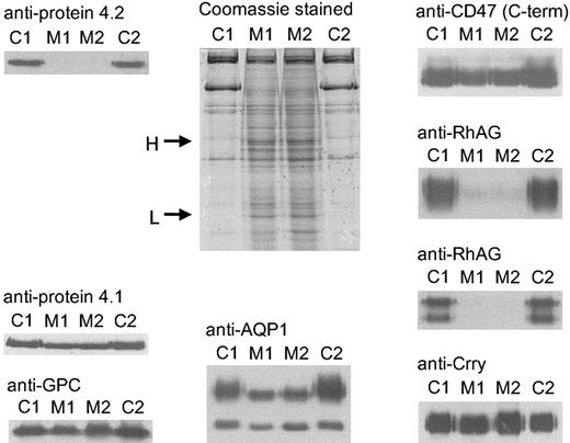 Fig. 2. Coomassie and immunostaining of proteins from band 3(−/−) mouse RBC membranes. / RBC membranes were separated on 10% or 12% Laemmli gels and immunoblotted using polyclonal antibodies as shown. Loading: C1, C2, controls 1 and 2, respectively; M1, M2, band 3(−/−) mice 1 and 2, respectively (C1 was C57BL/6 strain; M1, M2, and C2 were B6.129 strain). H and L on the protein-stained gel indicate the immunoglobulin H and L chains in the band 3(−/−) membranes. C-term indicates C-terminal.