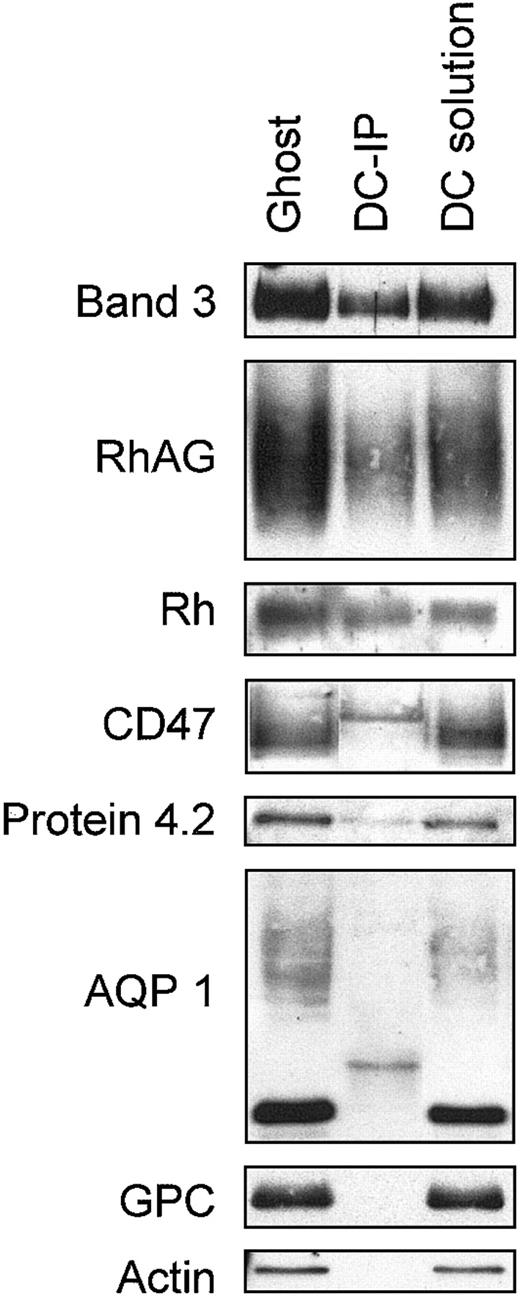 Fig. 5. Coimmunoprecipitation of band 3 and Rh proteins from human RBC membranes. / RBC membrane proteins were solubilized in a deoxycholate-containing buffer and were incubated with protein G-Sepharose, which had been preloaded with mouse monoclonal anti–band 3 (BRIC169), as described in “Materials and methods.” Immunoprecipitated protein was separated by SDS-PAGE and immunoblotted using rabbit polyclonal antibodies (“Materials and methods”) and a sheep anti–band 3.39Loading: ghost, RBC membrane protein; DC-IP, band 3 immunoprecipitate from deoxycholate-solubilized membrane proteins; DC solution, total deoxycholate-solubilized membrane proteins. Rabbit antibodies bound 2 bands in the DC-IP samples, at molecular weights of approximately 25 kDa and approximately 50 kDa (see panels AQP 1 and CD47, respectively), which probably results from cross-reactivity with the L and H chains of the large amount of mouse immunoglobulin in the immunoprecipitates.