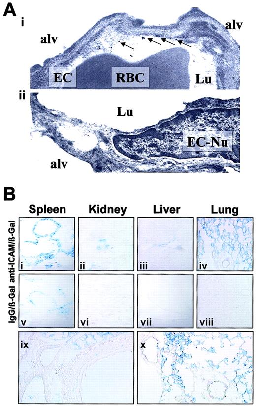 Fig. 6. Localization of anti-ICAM and anti-ICAM/β-Gal in the pulmonary vasculature after injection in mice. / (A) Immunogold electron microscopy of the lungs harvested 4 hours after intravenous injection of 100 μg anti-ICAM (i) or control IgG (ii). Arrows show endothelium-associated gold particles. RBC indicates red blood cells in a capillary lumen; Lu, vascular lumen; Alv, alveolar compartment; EC, endothelial cell; EC-Nu, endothelial cell nucleus. (B) Targeting of an active β-Gal conjugate was visualized 1 hour after injection in mice, using standard X-Gal chromogenic substrate staining protocol. Distribution of anti-ICAM/β-Gal (panels i-iv) and control IgG/β-Gal (panels v-viii). Detailed view of anti-ICAM/β-Gal in the lungs (panels ix and x). Original magnifications: Ai, × 70 000; Aii, × 60 000; Bi-Bviii, × 10; Bix-Bx, × 20.