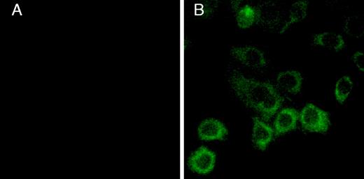 Fig. 2. Cell-surface expression of the FLAG-tagged human P2Y12 receptor on CHO-K1 cells. / The CHO-K1 cells transfected with (A) vector alone or (B) the FLAG-tagged human P2Y12 receptor cDNA construct were treated with FITC-conjugated anti-FLAG antibodies and visualized in a fluorescence microscope (original magnification, × 1000) after washing.