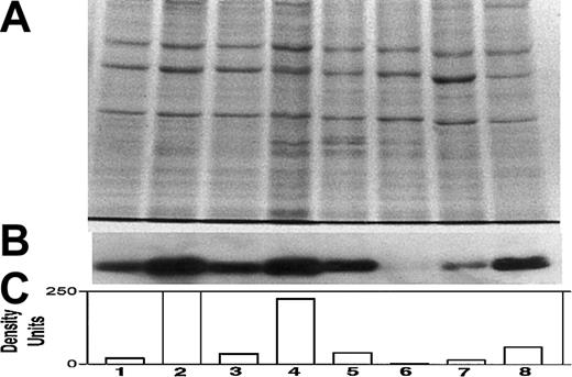 Fig. 1. Differential expression of Bcl-2 in various myeloma cell lines. / Expression of Bcl-2 was determined in all cell lines used in this study, relative to ARP-1 cells. (A) Coomassie blue staining for loading control; (B) immunoblot for Bcl-2; and (C) quantitation of Bcl-2 bands by densitometry. Extraction of cellular protein, SDS-PAGE, immunoblotting, and quantitation of Bcl-2 bands were performed as described previously.9 Bcl-2 protein expression in ARP-1 cells and in the Bcl-2–transfected (ARP-1/Bcl-2) cells is shown in lanes 1 and 2, respectively. The expression of Bcl-2 protein in RPMI 8226 and in the Bcl-2–transfected (8226/Bcl-2) cells is depicted in lanes 3 and 4, respectively. The expression of Bcl-2 in ARH-77, HS-Sultan, IM9, and U266 cells is depicted in lanes 5, 6, 7, and 8, respectively. The level of Bcl-2 expression in ARP-1 cells was used throughout this study as a benchmark for low expression of Bcl-2. HS-Sultan and IM9 express relatively low levels of Bcl-2, whereas ARH-77, U266, and the Bcl-2–transfected ARP-1 and 8226 express relatively high levels of Bcl-2. For more details, see “Materials and methods.”