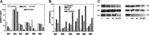 Fig. 11. Bcl-2-ASO potentiates down-regulation of Bcl-2 in DEX-treated freshly isolated myeloma cells. / Cells were treated as detailed in the footnote to Table1. The results obtained from flow-sorted myeloma cells in 6 MM patients (patients M1, M2, M3, M5, M6, and M9) outlined in Table 1 are presented. Apoptosis (B), Bcl-2 expression (C), and quantitation of Bcl-2 bands by densitometry (A) were determined in the same experiment. Note that in 3 of 6 cases, treatment with Bcl-2-ASO (AS) alone induced high levels of apoptosis with extensive down-regulation of Bcl-2 comparable or higher than DEX alone (DEX). However, the combination of both drugs (AS+DEX) resulted in all cases with additional decrease in Bcl-2 protein and additional increase in apoptosis. Also, in all cases tested, the observed decrease in Bcl-2 inversely correlated with the extent of apoptosis (A-C). “C” in panel C indicates control. Twenty-five micrograms of protein were loaded onto each gel. For further details, see the legend to Figure 1 and “Materials and methods.”