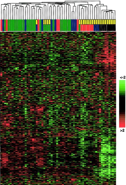 Fig. 1. Unsupervised hierarchic clustering of gene expression data generated from non-Hodgkin and AIDS-related lymphomas. / RNA extracted from 62 cases was converted into labeled cRNA and hybridized to U95A Affymetrix Gene Chips. AIDS-related NHL is indicated by a yellow rectangle; PEL, a black rectangle; centroblastic DLBCL, a blue rectangle; immunoblastic DLBCL, a green rectangle; and BL, a red rectangle. Unsupervised clustering can identify distinct cell types (eg, AIDS-NHL subtypes) that have not been classified a priori. The hierarchic clustering algorithm used to generate the dendrogram is based on the average-linkage method.1718 For construction of the dendrogram, see “Materials and methods.” The matrix below the dendrogram depicts the gene expression values of the individual samples, with columns representing individual tumor samples and rows representing individual genes ordered according to hierarchic clustering. The color scale identifies relative gene expression changes normalized by the standard deviation, with 0 representing the mean expression level of a given gene across the panel. Of note, the BL panel from immunocompetent patients included “classical” BL as well as atypical Burkitt/Burkitt-like tumors from elderly persons (see “Materials and methods”); this heterogeneity among the BL group may explain the apparent intermingled clustering in the dendrogram.
