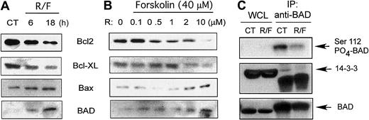 Fig. 5. Effect of rolipram/forskolin in CLL heavy-membrane fractions. / Rolipram/forskolin treatment reduces Bad Ser112 phosphorylation and association with 14-3-3 and augments Bad levels in CLL heavy-membrane fractions. (A) CLL cells were incubated with 10 μM rolipram and 40 μM forskolin (R/F) for the indicated period of time, followed by isolation of membrane-rich fractions (heavy-membrane) and immunoblotting for Bcl-2, Bcl-XL, Bax, or Bad as indicated. The “0” time point refers to culture for 18 hours in media with vehicle control alone. (B) CLL cells were cultured for 18 hours either with media (0) or 40 μM forskolin combined with the indicated concentration of rolipram, followed by analysis as for panel A. (C) CLL cells were cultured in media (CT) or 10 μM rolipram and 40 μM forskolin (R/F) for 18 hours. (Top) Whole-cell lysates (WCL)or Bad immunoprecipitates were immunoblotted with an antibody specific for phospho-Bad Ser112. (Middle) Treated as for top panel, but immunoblotted for 14-3-3. (Bottom) Treated as for top panel, but immunoblotted for Bad. Similar results were obtained in 3 of 5 CLL patients. At least 2 experiments were performed for each patient.