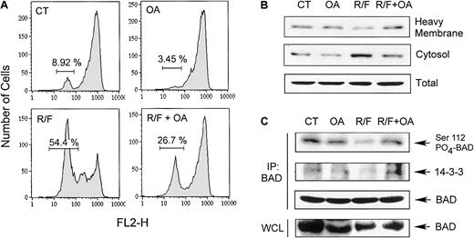 Fig. 7. Effect of cotreatment of CLL cells with the PP2Ac inhibitor okadaic acid. / Cotreatment of CLL cells with the PP2Ac inhibitor okadaic acid blocks rolipram/forskolin-induced mitochondrial depolarization and accumulation of cytoplasmic cytochrome c. (A) CLL cells were cultured for 18 hours in media (CT), 5 nM okadaic acid (OA), 10 μM rolipram and 40 μM forskolin (R/F), or the combination of okadaic acid, rolipram, and forskolin (R/F + OA). Mitochondrial depolarization was assessed by means of DiOC6(3) flow cytometry. The percentage of cells with depolarized mitochondria (reduced fluorescence) is shown. Similar results were obtained in 4 of 5 CLL patients. (B) CLL cells cultured as for panel A were subfractionated into heavy-membrane and cytosolic fractions, and immunoblotted for cytochrome c. Total cytochrome c, shown at the bottom, represents a sample in which equivalent portions of cytosolic and membrane fractions were combined. (C) CLL cells cultured as for panel A were immunoprecipitated with a BAD-specific antibody, then immunoblotted for phospho-Ser112 (top), 14-3-3 (second row), or BAD (third row). In addition, whole-cell lysates from the same samples were immunoblotted to assess total BAD (bottom). Similar results were obtained in leukemic cells from 3 of 5 CLL patients so examined.