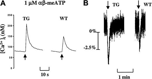 Fig. 2. Gain of P2X1 functionality in TG platelets. / (A) Increased P2X1-mediated Ca2+ influx in TG platelets. (B) Enhanced P2X1-mediated TG platelet shape change. Apyrase (2 U/mL)–treated washed platelets were stimulated with αβ-meATP (1 μM) in the presence of 2 mM CaCl2. Data are representative curves of at least 2 separate experiments performed in triplicate on platelet pools from 3 animals. Arrows indicate the addition of αβ-meATP (1 μM).