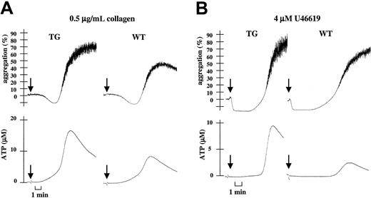 Fig. 5. Increased collagen- or U46619-induced platelet ATP secretion with transgenic platelets. / (A) Parallel recordings of light transmission (%) and ATP secretion (μM) in WT or TG mouse hirudinized PRP during platelet stimulation with 0.5 μg/mL collagen. (B) Identical experiment after platelet stimulation with 4 μM U46619. Data are representative of at least 3 independent experiments performed in duplicate on platelets from WT and TG mice.