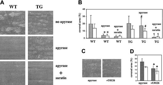 Fig. 6. Increased aggregate formation and PS exposure over a collagen surface under flow with transgenic platelets. / Inhibitory effect of U0126. Whole blood from WT or TG mice was perfused at a wall shear rate of 1000 seconds−1 for 4 minutes over a fibrillar collagen-coated surface. Blood from these 2 groups was assessed in the absence or presence of apyrase (0.1 U/mL) with or without saratin (10 μg/mL) and with or without U0126 (1 μM) for TG blood, as indicated. (A,C) Representative phase-contrast microscope images after perfusion. (B,D) Gray bars (░) represent the surface area coverage by platelets calculated from the phase-contrast images at the end of the perfusion period. White bars (■) represent the area coverage by platelets binding OG488-annexin V after perfusion (platelets exposing negatively charged PS) (n = 3-6) (*P < .001 vs WT;#P < .001 vs WT + apyrase;¶P < .001 vs TG + apyrase;♣P < 0.035 vs TG + apyrase).
