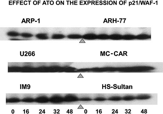 Fig. 4. ATO induces up-regulation of p21 expression in cells expressing wt p53. / Cells were cultured as above for 0, 16, 24, 32, and 48 hours with 6 μM ATO, and aliquots were taken for Western immunoblotting; 50 μg protein extract was loaded onto each lane. Loading control was performed according to the results obtained from a prerun of gels stained for protein by Coomassie blue and quantitation of protein bands by densitometry. For further experimental details, see the legend to Figure 8 and “Materials and methods.”