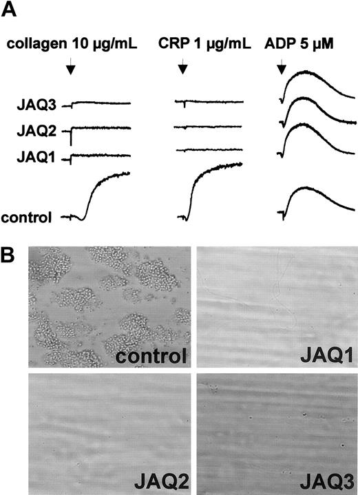 Fig. 4. In vitro analysis of GPVI-depleted platelets. / (A) Heparinized prp from mice on day 5 after treatment with irrelevant IgG2a or the indicated anti-GPVI mAb was stimulated with collagen, CRP, or ADP and light transmission was recorded. The results shown are representative of 6 mice/group. (B) Whole blood from mice treated with irrelevant IgG2a, JAQ1, JAQ2, or JAQ3 was perfused at wall shear rates of 1000 s−1 (4 minutes) over a collagen-coated surface and representative phase-contrast microscope images were taken (n = 3-6). Original magnification, × 630.