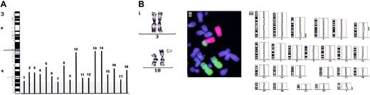 Fig. 1. Chromosomal assignment and size of gains of chromosome 3 material (vertical lines) in bone marrow cells of 18 FA patients detected by CGH and validated by FISH analyses. / (A) The critical trisomic or tetrasomic region 3q26q29 shared by all FA patients is shadowed in gray. (B) Cytogenetic and molecular cytogenetic analysis of patient 11. (i) Partial karyotype of chromosomes 3 and 10 after GTG banding of a bone marrow cell. The arrow points to the translocated material of chromosome 3 onto chromosome 10. (ii) Whole chromosome paints for chromosome 3 (green) and chromosome 10 (red) on a BM metaphase plate for the validation of CGH results. (iii) Averaged CGH copy number karyotype of patient 11 indicating the gain of chromosome 3q25qter material (green bar right of chromosome 3). Ratio deviations in heterochromatic parts of chromosomes and in the X and Y chromosome are generally excluded from evaluation.