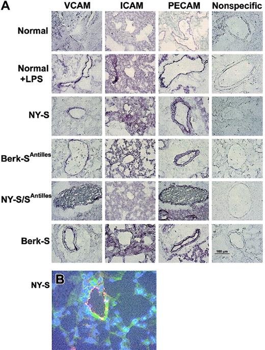 Fig. 1. Adhesion molecules VCAM, ICAM, and PECAM are up-regulated in LPS-treated normal and transgenic sickle mouse lungs. / (A) Immunostaining of frozen thin sections prepared from the lungs of transgenic sickle mice and LPS-treated normal mice (18 hours after LPS injection) exhibit up-regulated VCAM, ICAM, and PECAM compared with normal lung controls. Immunostaining with nonspecific IgG gave minimal background staining. Frozen thin sections were prepared and stained using 3 mice from each model and controls. The figure shows one representative field from each mouse model and control. Magnification was × 40 for all figure panels. A 100-μm bar can be seen in the lower right panel, showing nonspecific IgG staining in the Berk-S lungs. (B) Immunofluorescence staining demonstrates VCAM (green) colocalization with von Willebrand factor (red) in the lungs of a NY-S mouse. Nuclei are counterstained (blue) with DAPI. Colocalized VCAM and von Willebrand factor appear yellow. Magnification was × 40. Colocalization was also seen using serial thin sections from lungs taken from other transgenic sickle mice (data not shown).