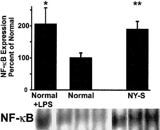Fig. 4. Electrophoretic mobility shift assay (EMSA) demonstrates that NF-κB is up-regulated in the lungs of transgenic NY-S mice and LPS-treated normal mice (18 hours after LPS injection) compared with normal lung controls. / Lung cell extracts were isolated from lung homogenates prepared from 3 NY-S mice, 3 normal control mice, and 2 LPS-treated controls. Lung cell extracts from 260 ng lung DNA were incubated with end-labeled32P-dsDNA containing a consensus murine NF-κB DNA binding sequence (underlined): 5′-AGTTGAGGGGACTTTCCCAGGC-3′. DNA-protein binding reactions were carried out with each extract and separated by electrophoresis. Radioactive bands corresponding to NF-κB–DNA complexes were quantified by phosphorescence densitometry. The figure shows the bands from the lungs of one LPS-treated normal mouse, 3 normal control mice, and 3 transgenic NY-S mice. The summary bar graph plots the mean ± SD lung NF-κB expression for each mouse group as a percentage of normal control mice (n = 3 for NY-S and normal control, n = 2 for LPS-treated control). *P ≤ .05; **P ≤ .01.