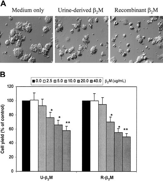 Fig. 1. Morphologic features and yields of immature MoDCs. / (A) Morphologic features of immature MoDCs harvested on day 7 of culture with or without the addition of 20 μg/mL urine-derived or recombinant β2M. Representative fields of differential interference contrast microscopy (original magnification × 300) of more than 5 separate experiments are shown. (B) Yields of immature MoDCs (viable cell counts of big cells only) from day 7 culture with or without the addition of varying concentrations (2.5-40 μg/mL) of urine-derived (U-β2M) or recombinant (R-β2M) β2M. Data are expressed as a percentage of the control. Mean ± SEM from 3 experiments are shown. *P < .05; **P < .01.