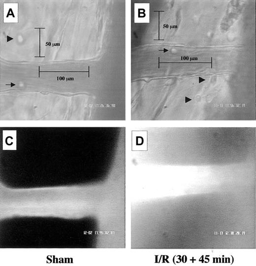 Fig. 1. Visible alterations in the mouse mesenteric microcirculation following I/R of the SMA. / Images are representative pictures of the mouse mesenteric microcirculation as observed in sham-operated mice (A,C) and following occlusion and reopening of the SMA (30 minutes + 45 minutes) (B,D). (A) Clear example of a noninflamed vessel in the sham group as observed 75 minutes after laparoctomy. Arrow and arrowhead highlight 2 mast cells in the extravascular tissue, whereas segment illustrates the canonical 100 μm vessel length. (B) Typical signs of leukocyte recruitment as seen 45 minutes after reperfusion, with cells adherent to the postcapillary venule endothelium (arrow) and migrated into the extravascular space (arrowheads). Segment illustrates depth (50 μm) into the extravascular tissue. (C) In sham-operated mice, most fluorescent albumin is found intravascularly. (D) Example of diffuse fluorescence in mesenteries subject to I/R. Pictures are representative of n = 4 to 8 mice per group. Original magnification, × 400.