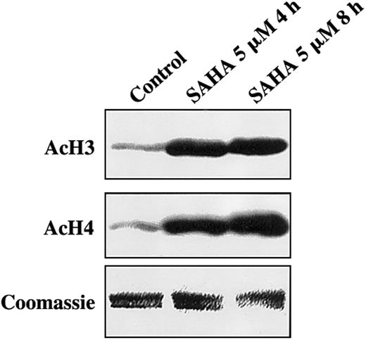 Fig. 1. SAHA induces accumulation of acetylated histones in MM.1S cells. / MM.1S cells treated with SAHA for 4 or 8 hours exhibited significantly increased acetylation of histones H3 (AcH3) and H4 (AcH4) than untreated controls. Equal loading of histones was confirmed by Coomassie blue.