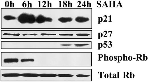 Fig. 3. Mechanism of SAHA-induced growth arrest. / Growth arrest induced by SAHA (5 μM) in MM.1S cells is associated with early up-regulation of p21, but not p27, and dephosphorylation of Rb, as evidenced by immunoblotting. p53 is also up-regulated, but at a later time point.