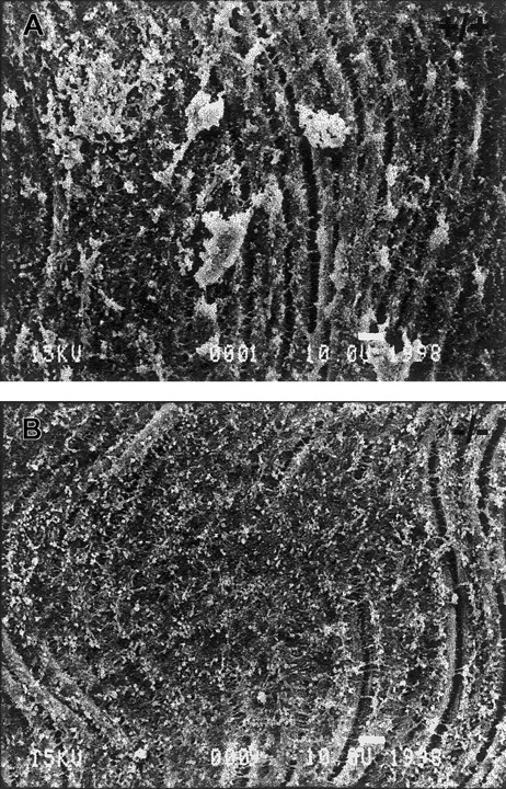 Fig. 1. TSP2-null mice fail to form platelet aggregates normally in vivo. / Representative SEM images of denuded carotid artery subendothelium 10 minutes following injury. Numerous platelet aggregates can be seen in wild-type mice (A), whereas none are observed in TSP2-null mice (B). A total of 5 mice per genotype were analyzed. Bar represents 10 μm.