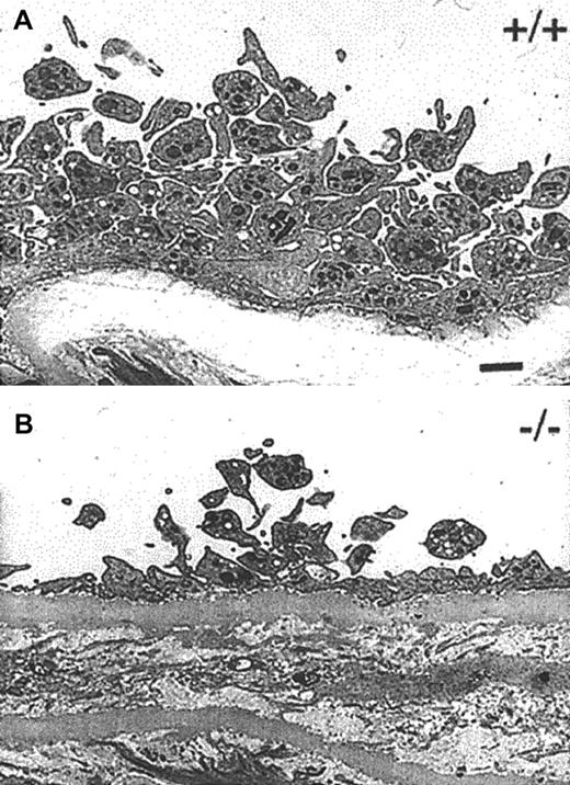 Fig. 2. TEM images of platelet aggregates. / Representative TEM images of denuded carotid artery subendothelium 10 minutes following injury. A large platelet aggregate with several layers of intimately associated platelets can be seen in wild-type mice (A). A glancing section of the internal elastic lamina is seen as a white band. In contrast, a small aggregate of platelets displaying minimal interactions can be seen in TSP2-null mice (B). A total of 5 mice per genotype was analyzed. Bar represents 1 μm.