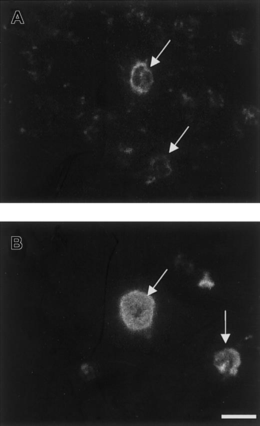 Fig. 5. Immunolocation of TSP2 in MKs in vivo. / Anti-TSP1 and anti-TSP2 antibodies were used to immunolocalize their respective antigens in cryosections of bone marrow. Reactions were visualized by FITC-conjugated IgG. TSP1 was abundantly distributed in the cytoplasm of all MKs (B), whereas TSP2 was present in a subset of MKs and was detected at the cell boundary (A). TSP2 was also present in the marrow stroma (A). Arrows indicate MKs. Bar represents 25 μm (A-B).