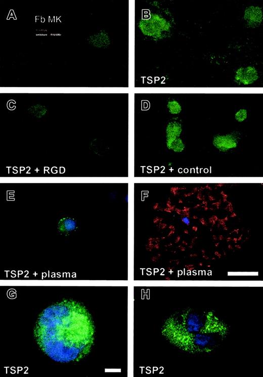 Fig. 6. Integrin-mediated uptake of TSP2 by MKs in vitro. / rTSP2 was added to MKs in panels B-F. MKs were grown in the absence (A-D) or presence (E-F) of plasma. The uptake of TSP2 was inhibited by an RGD-containing peptide (C) but not by a control peptide (D). The inset in panel A shows results of RT-PCR with TSP2-specific primers (top bands) and with ribosomal protein SP6-specific primers as control (bottom bands) from dermal fibroblasts (Fb) and MKs. Representative images, obtained by confocal microscopy, of rTSP2-treated MKs grown in the absence of plasma are shown (G-H). Uptake of TSP2 was detected by FITC-conjugated IgG. Nuclei in panels E-H were visualized with DAPI, and the cytoskeleton in panel F was visualized with phalloidin. Bars represent 25 μm (A-F) and 10 μm (G-H).