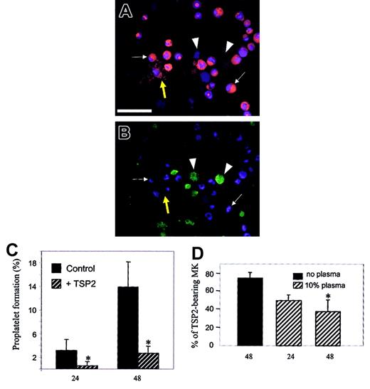 Fig. 7. TSP2 inhibits MK differentiation. / MKs were allowed to take up TSP2 for a period of 24 hours and were then placed in media containing 10% plasma to induce differentiation. Uptake of TSP2 was detected by FITC-conjugated IgG. Nuclei and the actin cytoskeleton were visualized with DAPI and phalloidin, respectively. Panels A and B represent images of the same field showing a combination of phalloidin and DAPI stain (A) and FITC-conjugated IgG and DAPI (B). Small arrows in panels A and B indicate cells that contain bundled actin but lack TSP2, whereas arrowheads indicate cells that lack bundled actin but contain TSP2. Yellow arrow (A-B) shows proplatelet-forming MKs, with numerous pseudopodia, that are devoid of TSP2. The effect of the uptake of TSP2 by MKs on their differentiation was quantified at 24 and 48 hours following the replacement of plasma-containing media (C). At both time points, uptake of TSP2 resulted in a reduction in the number of proplatelet-forming MKs. Addition of 10% plasma also resulted in a reduction in the number of MKs that contain TSP2 (D). Bar represents 50 μm (A-B). *P ≤ .05