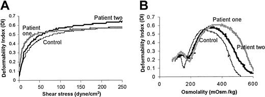 Figure 1. Evaluation of erythrocytes from patients with hereditary hydrocytosis and from healthy donors by ektacytometry. (A) Whole cell deformability was measured by subjecting isotonic erythrocytes to increasing shear stress. (B) Osmotic deformability was measured by subjecting erythrocytes to moderate shear stress while increasing osmotic pressure. The data shown were highly similar in 2 experiments conducted on the patients' blood collected on 2 separate occasions.