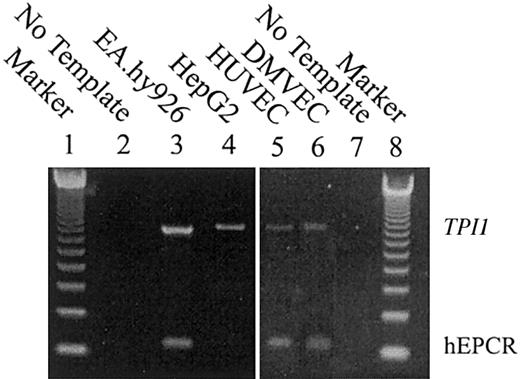 Figure 3. Multiplex RT-PCR analysis of EA.hy926, HUVEC, and HepG2 mRNA extracts. Multiplex RT-PCR was performed on RNA prepared from EA.hy926 cells, HepG2 cells, HUVECs, and DMVECs (lanes 3-6). Primers were designed to span intron 3 of the hEPCR gene, and the size of the expected hEPCR transcript-dependent PCR amplification product was 125 bp. To confirm the integrity of RNA, RT-PCR was performed in multiplex with a housekeeping gene (TPI1). The expected size of amplification product was 884 bp. The amplified products were separated on a 2% agarose gel and compared with a 123 bp oligonucleotide ladder (lanes 1 and 8) and a no-RNA template negative control (lanes 2 and 7).