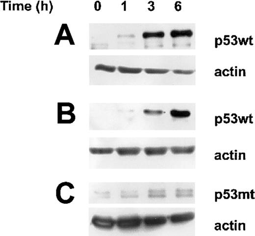 Figure 2. Accumulation of p53wt following irradiation in both sensitive and resistant B-CLL cells. Western blot analysis of the nuclear protein levels of wild-type (wt) and mutated (mt) p53 at indicated time after irradiation was compared to untreated cells (time 0). According to cell susceptibility to undergo or not apoptosis following irradiation, an equal amount of total proteins derived from 1.5 × 106 B-CLL cells sensitive (A) or resistant (B) both expressing p53wt and resistant cells expressing p53mt (C) was deposited in each lane and evidenced by actin protein level as control. The results are representative analyses of 11 sensitive and 6 resistant samples expressing p53wt as well as 5 resistant B-CLL samples expressing p53mt.