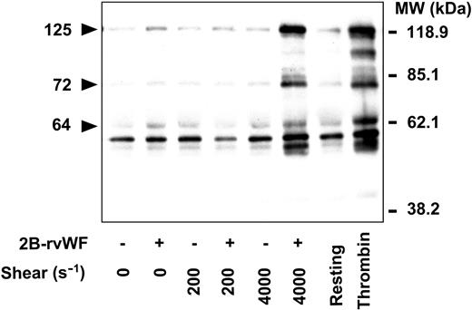 Figure 2. Effect of increasing shear rates on platelet tyrosine phosphorylations. Platelets (2.8 × 108/mL) in the absence (–) or presence (+) of 2B-rVWF (0.7 μg/mL), were submitted to increasing shear rates (0 s–1, 200 s–1, and 4000 s–1) for 4.5 minutes at 37°C. Lysates were prepared as described in “Materials and methods.” On the right side of the figure, platelets were either unstimulated (Resting) or stimulated by 0.5 U/mL thrombin for 2 minutes in a lumi-aggregometer. Positions of the molecular mass markers are indicated on the right side and the positions of 3 bands that are strongly phosphorylated are indicated on the left side by arrowheads. MW indicates molecular weight. Data are representative of 3 experiments.