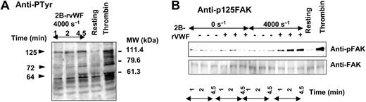 Figure 3. Time course of protein tyrosine phosphorylation induced by 2B-rVWF. Platelets (2.8 × 108/mL) were either mixed with buffer (–) or with 2B-rVWF at 0.7 μg/mL (+) in the absence (0 s–1) or in the presence (4000 s–1) of high shear rate. Proteins of the lysates were separated on a 8% polyacrylamide gel, transferred to a nitrocellulose membrane, and blotted with antiphosphotyrosine (A) or anti-pFAK/FAK antibody (B), using either anti–phospho-FAK or anti-FAK. On the right side, resting or thrombin-stimulated platelets are shown. Data are representative of 3 experiments.