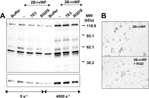 Figure 7. Inhibitory effect of αIIbβ3 inhibitors on SIPA-associated protein tyrosine phosphorylation and p125FAK phosphorylation. (A) Platelets (2.8 × 108/mL) were preincubated with MoAb 7E3 (20 μg/mL) or RGDS peptide (1 mM) for 5 minutes at room temperature, prior to exposure to 2B-rVWF (0.7 μg/mL) for 4.5 minutes at 37°C under high shear rates. Buffer indicates samples without 2B-rVWF. Lysates were prepared as described in “Materials and methods,” separated by an 8% polyacrylamide gel, transferred to nitrocellulose membrane, and blotted with antiphosphotyrosine MoAbs 4G10 and PY20 (top). Membranes were then stripped and reprobed with anti–phospho-FAK polyclonal antibody (bottom). Data are representative of 3 experiments. (B) In separate experiments, platelets and 2B-rVWF, in the absence (top) or the presence (bottom) of the RGD-containing disintegrin kistrin at 50 nM, were exposed to shear and fixed with PFA. An aliquot was deposited in microtiter plates for microscopic observation of aggregates, as described in the legend to Figure 6C.